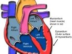 Myocarditis refers to inflammation of the heart muscle. Myocarditis. Causes, symptoms, treatment Myocarditis