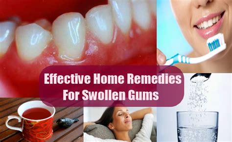 Simple Home Remedies And Treatments For Swollen Gums Lady Care Health