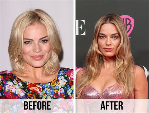 Has Margot Robbie Had Any Plastic Surgery Doctors Weigh In