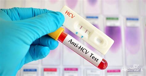 Anti HCV Test How Does It Detect Hepatitis C Infection