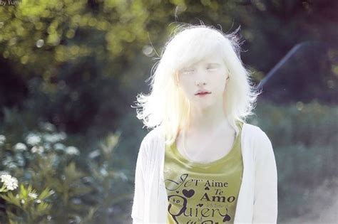 Nastya Kiki Zhidkova Nastya Zhidkova Pinterest Albinism