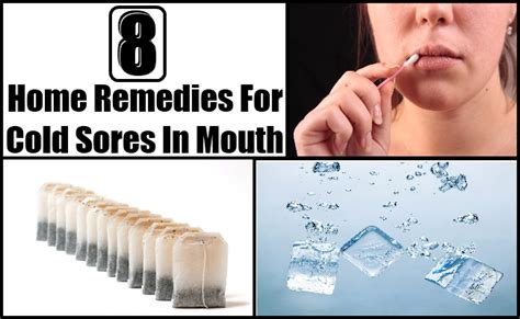Canker sores usually appear inside your mouth, while cold sores appear. Herpes Ulcers Inside Mouth - Herpes Remedy Secrets