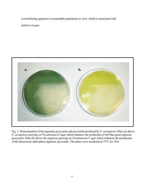 Construction Of A Pseudomonas Aeruginosa Dihydroorotase Mutant And The