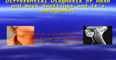 Differential Diagnosis Of Head And Neck Swellings And Its Management M