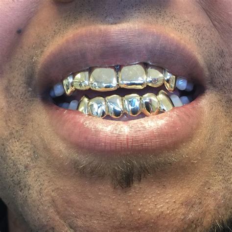 Our Gallery Grillz Pro