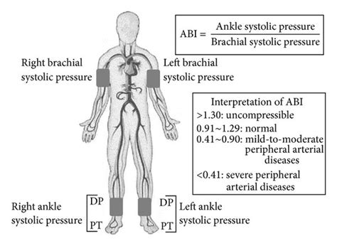 Measurement Of The Ankle Brachial Index Abi Dp Indicates Dorsalis