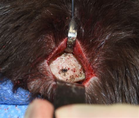 Plastic Surgery Case Study Reduction Of The Hidden Occipital Knob