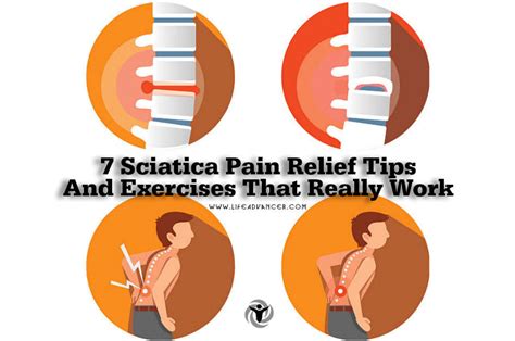 7 Sciatica Pain Relief Tips And Exercises That Really Work