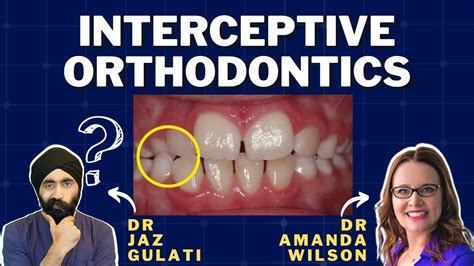 Interceptive Orthodontics For The General Dentist Pdp128 Youtube
