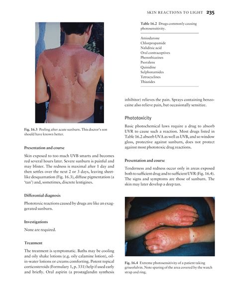 Medicine By Sfakianakis G Alexandros Skin Disease In Perspective 4