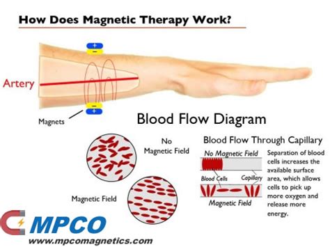 How Magnet Therapy Work Mpco Magnets