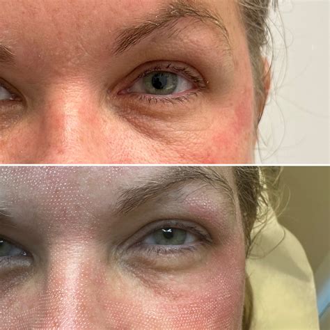 Gallery | Laser Solutions | Medical Spa Serving Mount Pleasant, SC