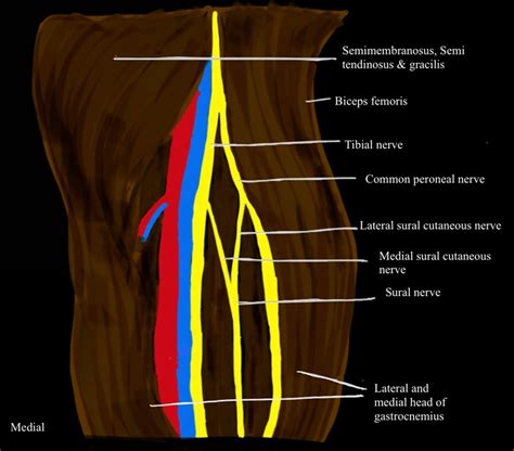 How I Do It Ultrasound Guided Sciatic Nerve Block At The Popliteal Fossa