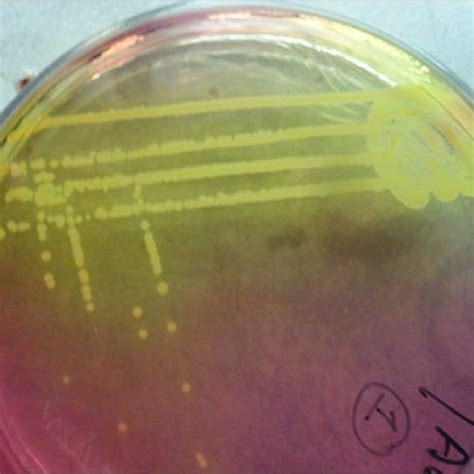 Growth Of Staphylococcus Aureus On Mannitol Salt Agar Download