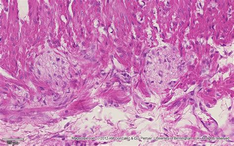 Browse the use examples 'auerbach's plexus' in the great english corpus. Histology Slide Download. Magscope.com