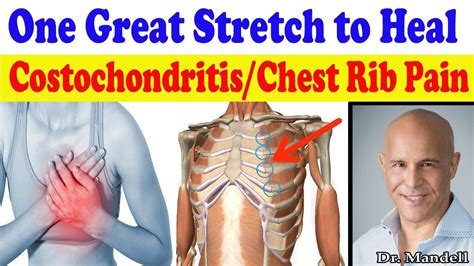 70 Awesome Can Spine Problems Cause Chest Pain Insectza