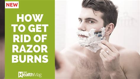 How To Get Rid Of Razor Bumps And Burns Naturally YouTube