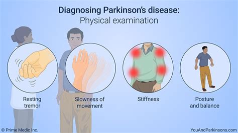 Diagnosing Parkinsons Disease Physical Examination Your Doctor Will
