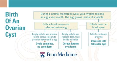 Ovarian Cysts 101 Penn Medicine