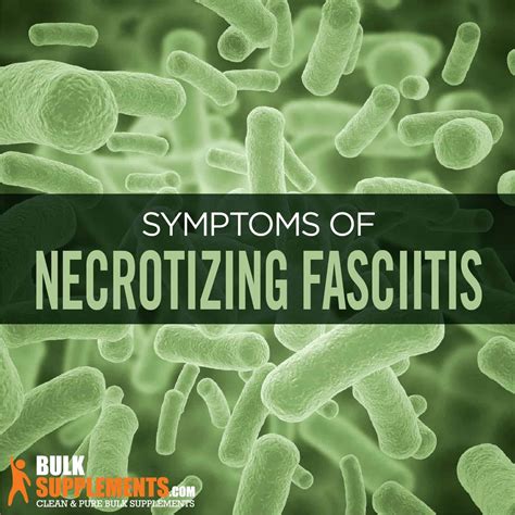 Necrotizing Fasciitis Symptoms Causes And Treatment