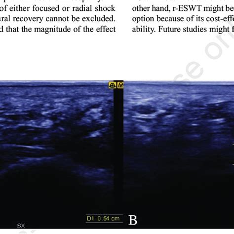 Ultrasound Evaluation Of Illustrative Patient At Baseline Left And 1