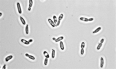 Microscope Yeast Candida Micropedia