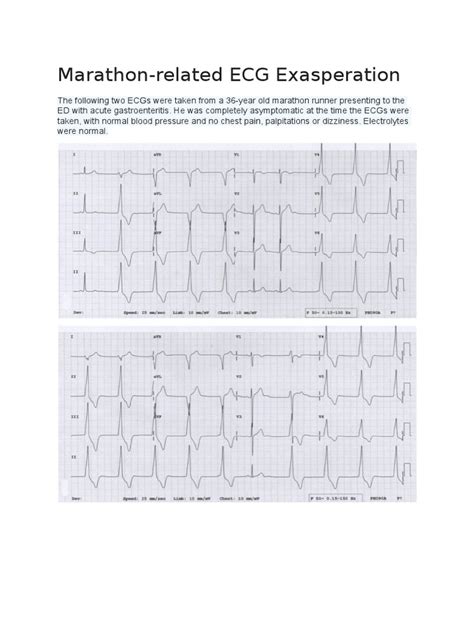 Ecg Cardiac Arrhythmia Electrocardiography