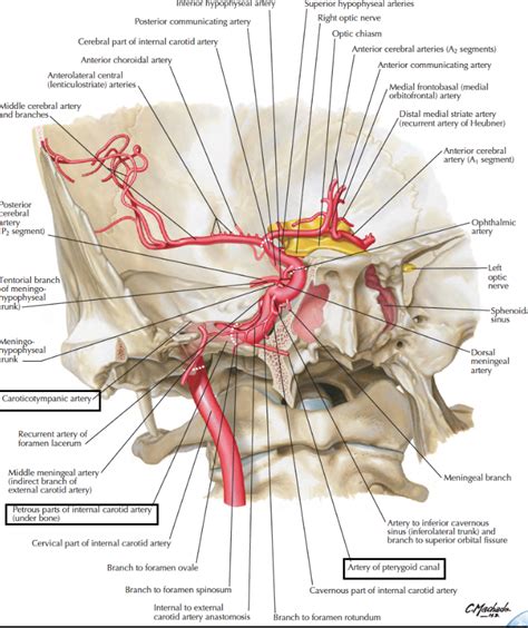 It usually occurs in the absence of any trauma to the head or neck, and the pain is generally not associated with a recent infectious illness. Head & Neck Anatomy: Internal Carotid Artery