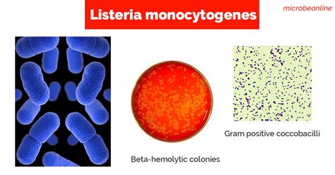 Listeria Monocytogenes Properties Pathogenesis Lab Diagnosis