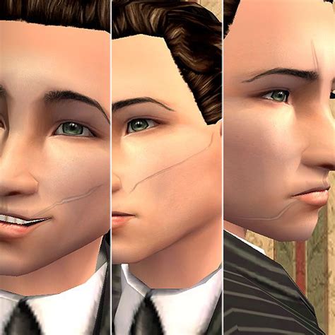 Sims 4 Scars And Wounds
