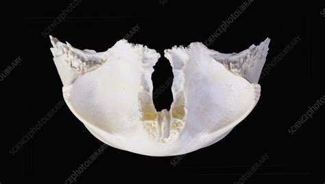 Frontal Bone Of Human Skull Stock Image C0055387 Science Photo