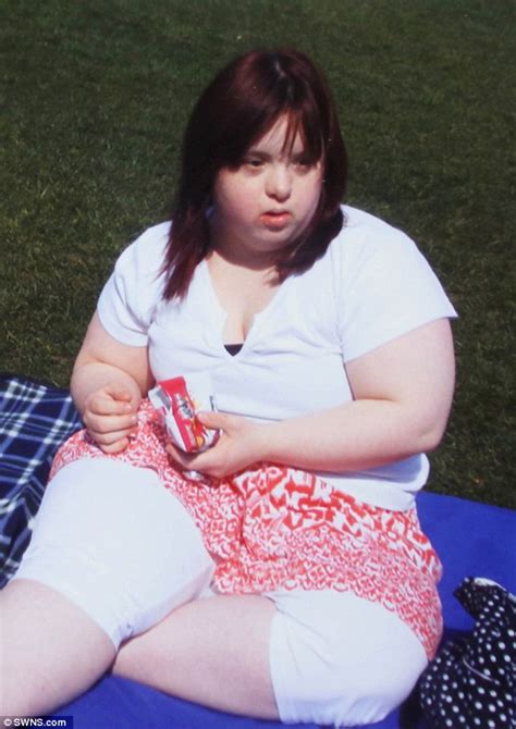 Woman With Downs Syndrome Loses Six Stone Daily Mail Online