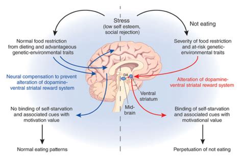 Eating Disorders Leigh Brain And Spine