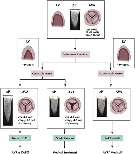 E Evaluation Algorhythm For Severe Aortic Stenosis With Lv Dysfunction Download Scientific