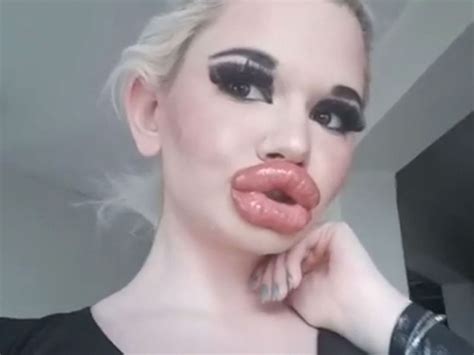 Why Do Humans Have Big Lips Sitelip Org