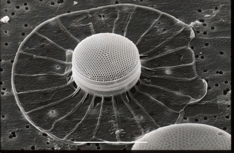Electron Microscope Photo Of Diatom Algae Pics