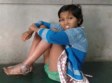 Help This 10 Year Old Girl So That She Doesnt Lose Her Leg Milaap