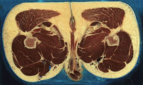 Top cross sectional anatomy flashcards ranked by quality. Upper Thigh Cross Sectional Anatomy / Chapter 12 ...