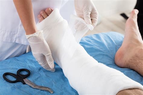 Coping With A Cast And Tips For Your Cast Care Chester County