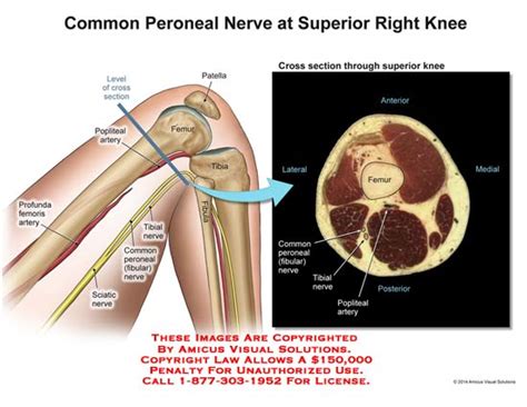 Common Peroneal Nerve At Superior Right Knee