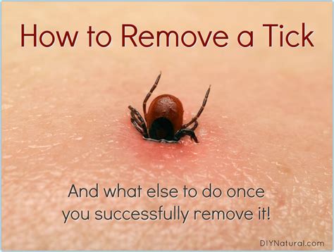 How To Remove A Tick And What To Do Once Youve Been Bitten Ticks