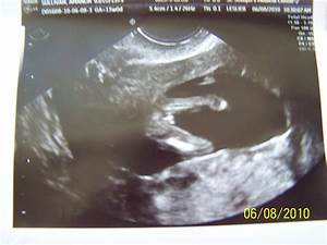 Baby Boy Scan Pictures At 20 Weeks Search Results Calendar 2015