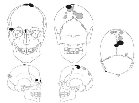 Human Skulls Mounted On Stakes Found At 8000 Year Old Burial