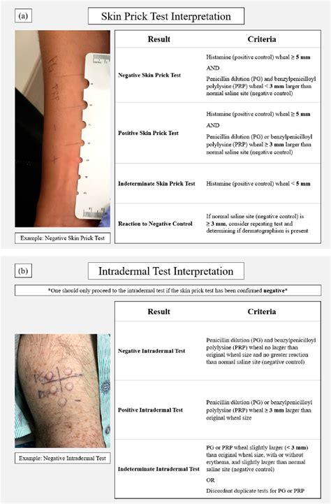 Figure 1 From Penicillin Allergy Skin Testing In The Inpatient Setting