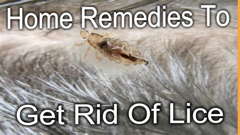 Getting Rid Of Lice Home Remedies To Get Rid Of Lice घरेलू उपचार जूँ से