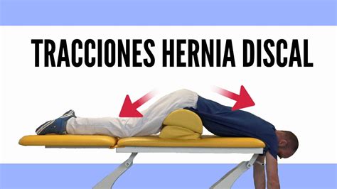 Hernia Discal 2 Tracciones Para Descomprimir La Columna Lumbar Youtube