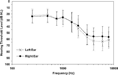Mean Hearing Thresholds And Standard Deviations For Left And Right Ears