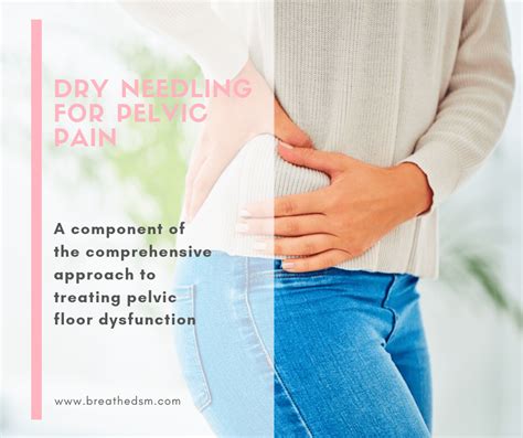 pelvic floor dry needling