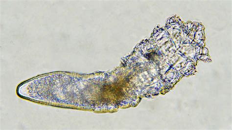 Zeyneptas cengiz, hatice uce ozkol, yunus emre beyhan, murat ozturk, hasanyilmaz.evaluation of some chronical diseases in etiopathogenesis of demodicosis.dermatologica sinica,. Meet The Mites That Live On Your Face | WBUR News