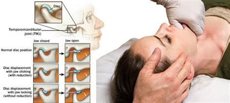 how you can treat tmj disorders with osteopathy ultimate health clinic